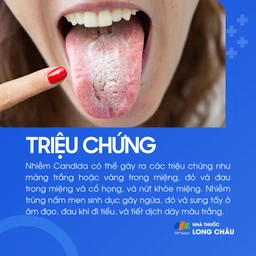 Triệu chứng nhiễm nấm Candida gồm: mảng trắng/vàng trong miệng, đau họng, nứt khóe miệng, ngứa và dịch âm đạo trắng đục