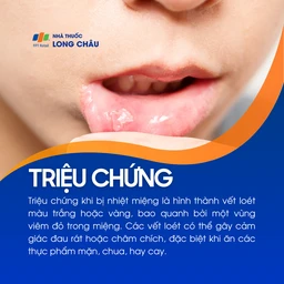 Vết loét trắng trong miệng gây đau rát khi ăn mặn, chua, cay