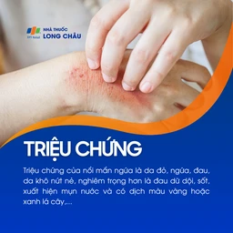 Nổi mẩn ngứa 2