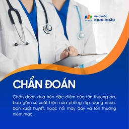 Nổi mẩn ngứa 5