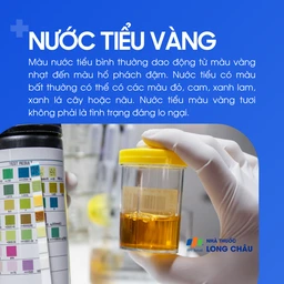Nước tiểu vàng 1
