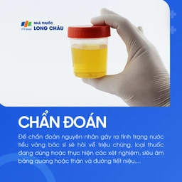 Nước tiểu vàng 5
