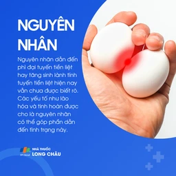 Phì đại tuyến tiền liệt 3