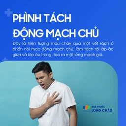 Phình tách động mạch chủ 1
