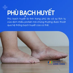 Phù bạch huyết 1