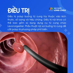 Polyp buồng tử cung 6