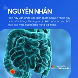 Polyp đại tràng 3