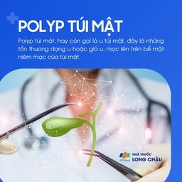 Polyp túi mật 1
