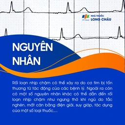 Rối loạn nhịp chậm 3
