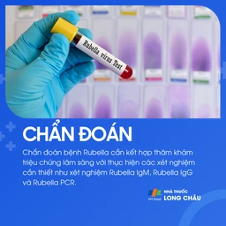 Rubella 5