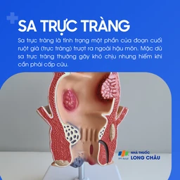 Sa trực tràng 1