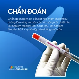 Chẩn đoán bệnh sởi bằng xét nghiệm PCR và IgM IgG
