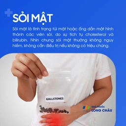 Sỏi mật 1