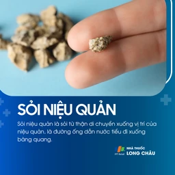 Sỏi niệu quản 1