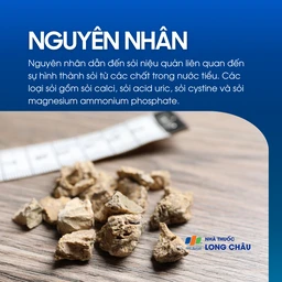 Sỏi niệu quản 3