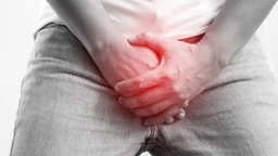 Sùi mào gà dương vật​ là gì? Triệu chứng, nguyên nhân, chẩn đoán, điều trị và phòng ngừa 1