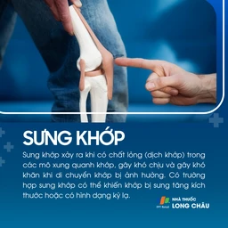 Sưng khớp 1