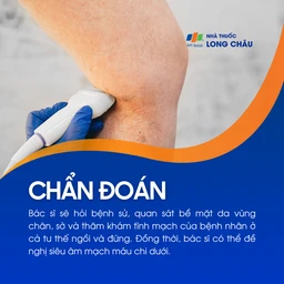 Suy giãn tĩnh mạch sâu chi dưới 5
