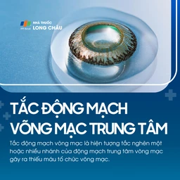 Tắc động mạch võng mạc trung tâm 1