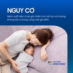 Teo đường mật bẩm sinh 4