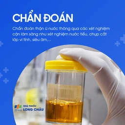 Thận ứ nước 5