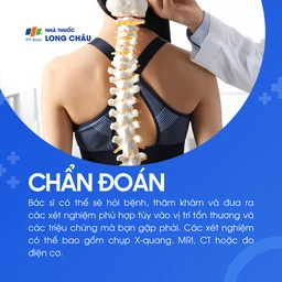 Tai biến mạch máu não 5