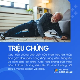 Thoái hóa đa khớp 2