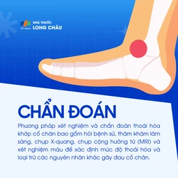 Thoái hóa khớp cổ chân 5