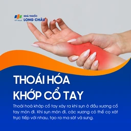 Thoái hóa khớp cổ tay 1