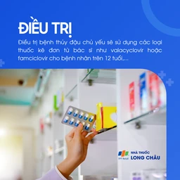 Điều trị varicella bằng thuốc kháng virus và các biện pháp chăm sóc giảm ngứa