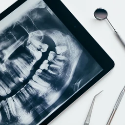 Tiêu xương hàm 3