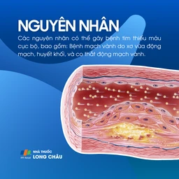 Tim thiếu máu cục bộ 3