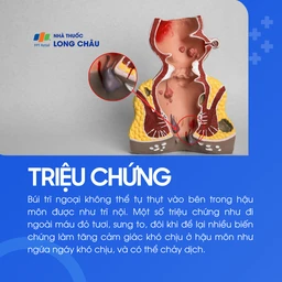 Trĩ ngoại 2