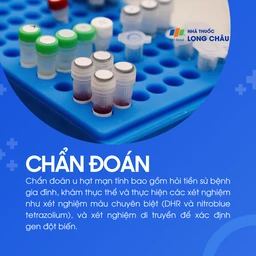 U hạt mạn tính 5