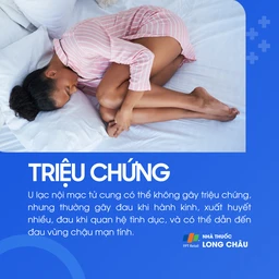 U lạc nội mạc tử cung 2
