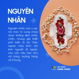 U lạc nội mạc tử cung 3