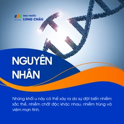 U lympho không Hodgkin 3