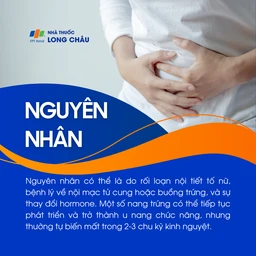 U nang buồng trứng 3