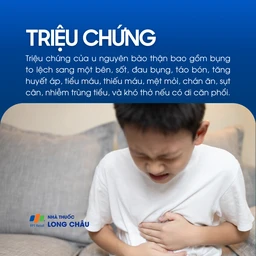 U nguyên bào thận 2