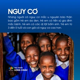 U nguyên bào thận 4