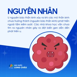 U nguyên bào thần kinh 3