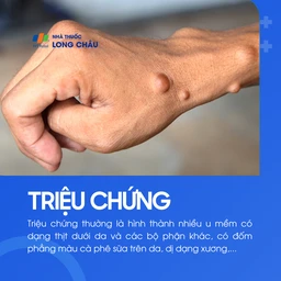 U sợi thần kinh 2