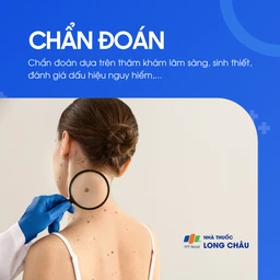 U tế bào hắc tố 5