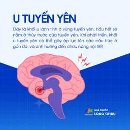 U tuyến yên 1