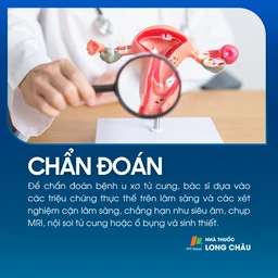 U xơ tử cung 5
