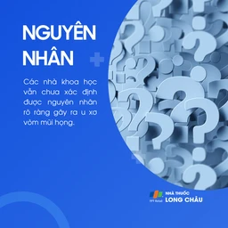 U xơ vòm mũi họng 3