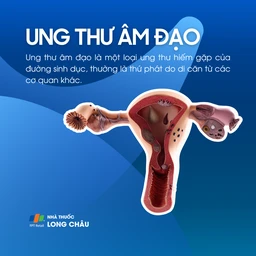 Ung thư âm đạo 1