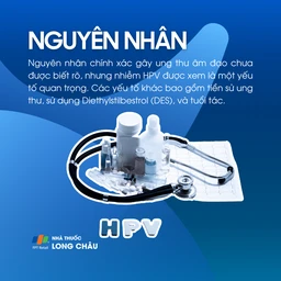 Ung thư âm đạo 3