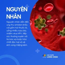 Ung thư amidan khẩu cái 3