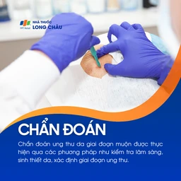 Ung thư da giai đoạn muộn 5
